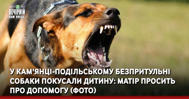 У Кам'янці-Подільському безпритульні собаки покусали дитину: матір просить про допомогу