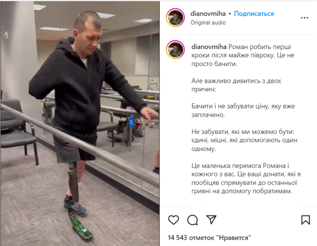 діанов протез хм