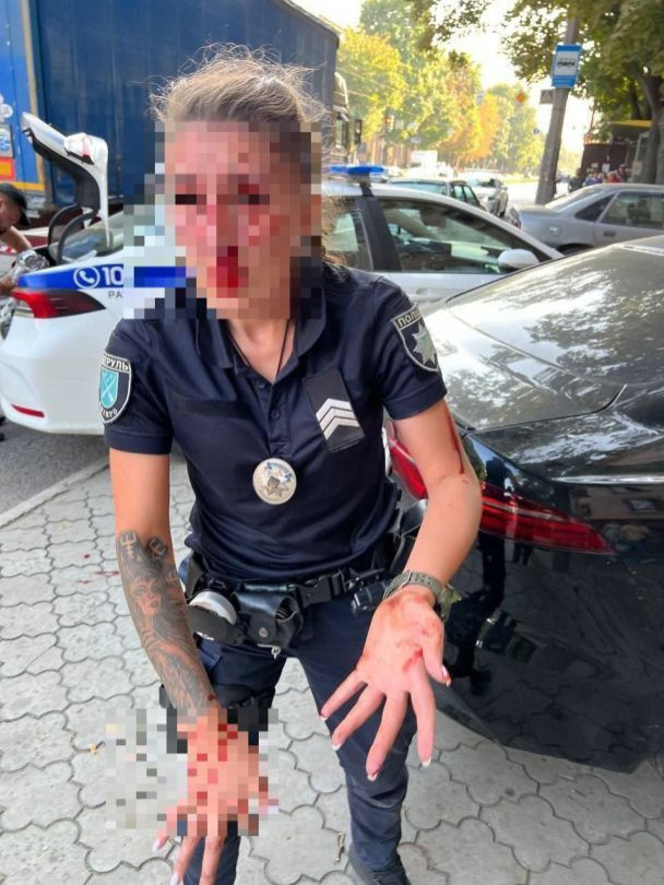 побита поліецйська